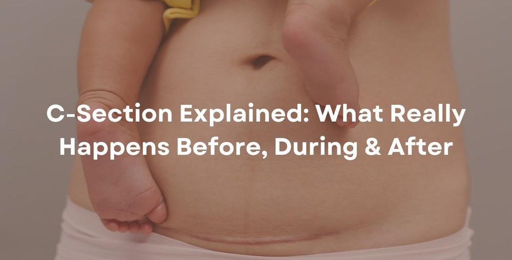 C-Section Explained: What Really Happens Before, During & After