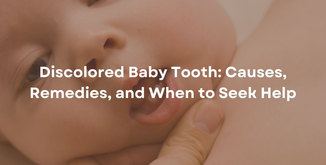 Discolored Baby Tooth: Causes, Remedies, and When to Seek Help