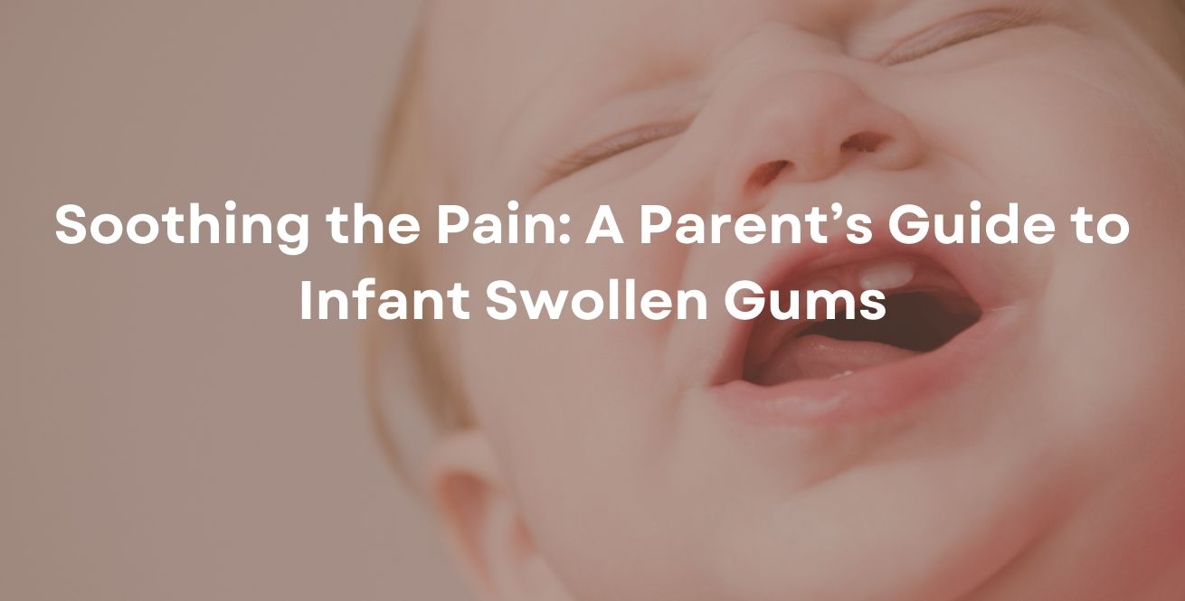 Soothing the Pain: A Parent’s Guide to Infant Swollen Gums