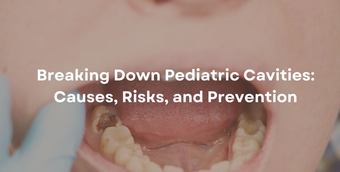 Breaking Down Pediatric Cavities: Causes, Risks, and Prevention