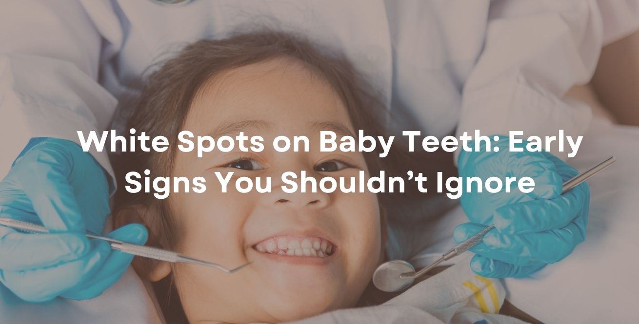 White Spots on Baby Teeth: Early Signs You Shouldn’t Ignore