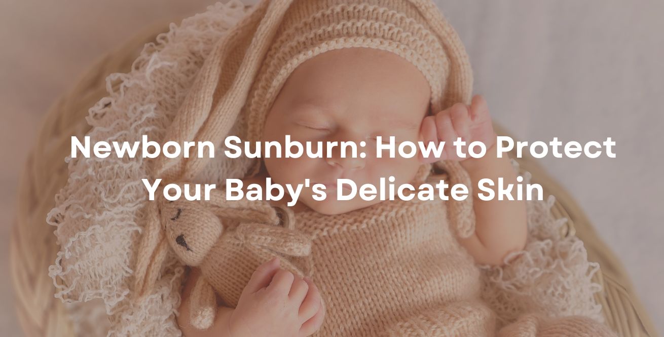 Newborn Sunburn: How to Protect Your Baby's Delicate Skin