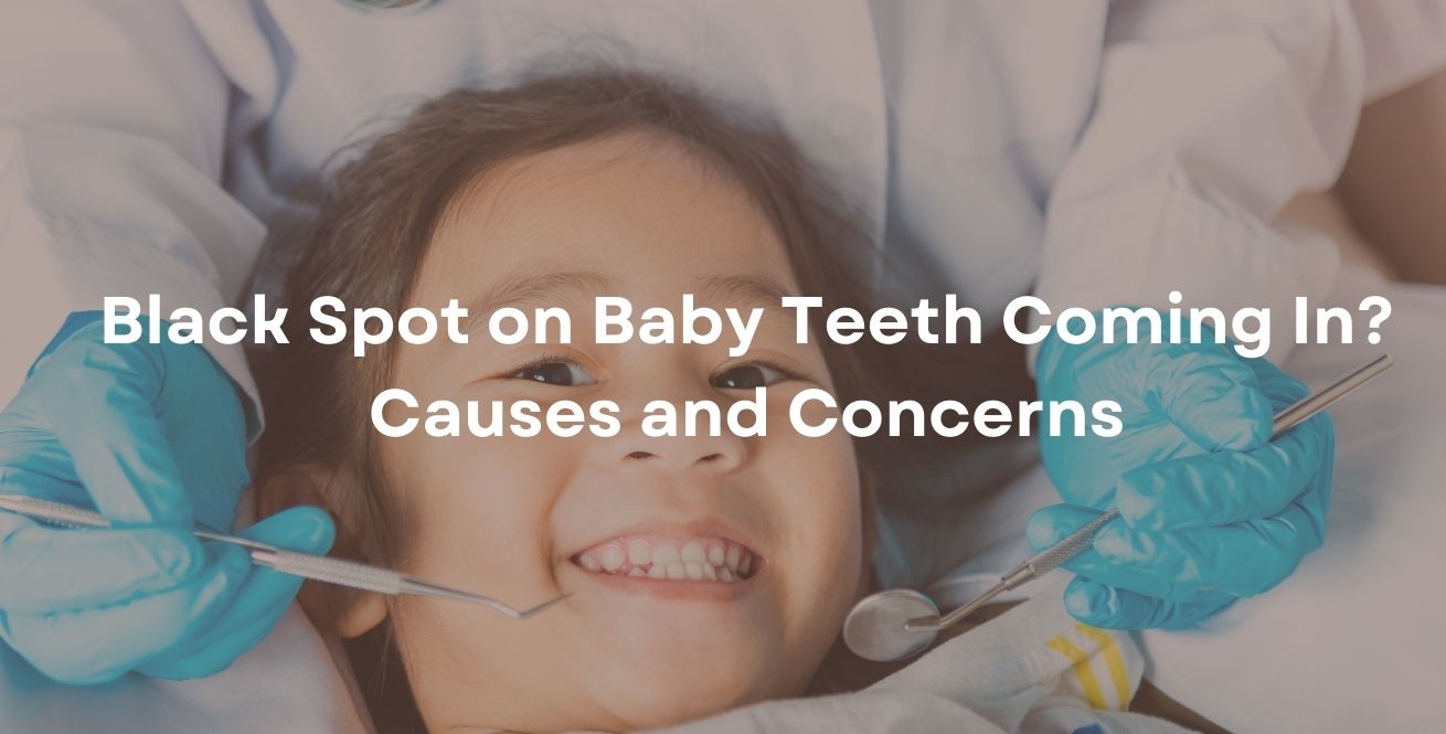 Black Spot on Baby Teeth Coming In? Causes and Concerns