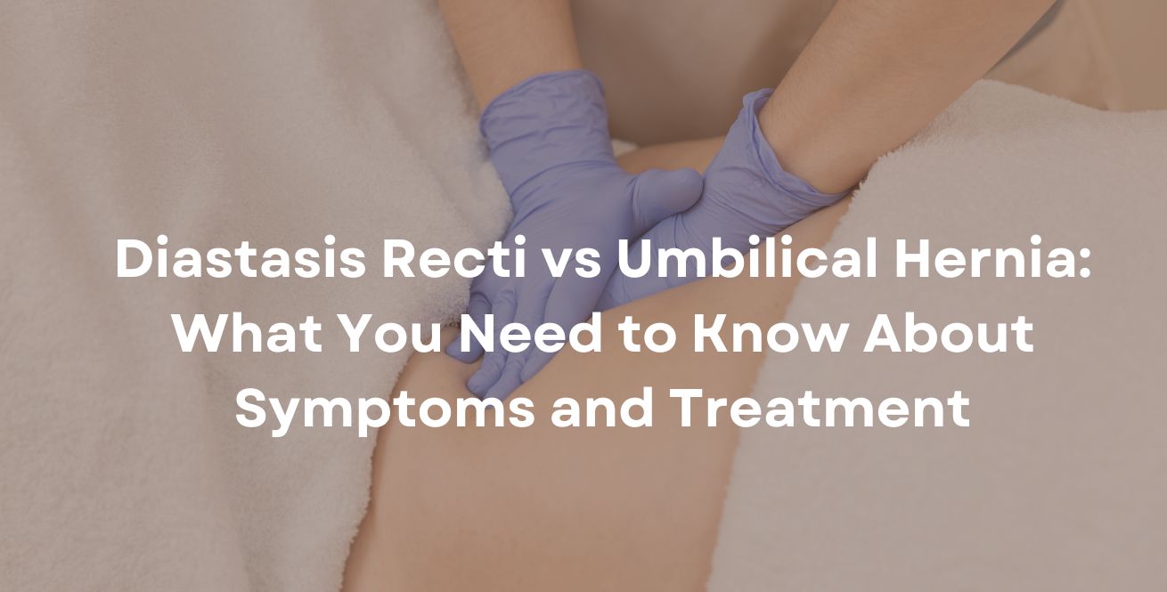 Diastasis Recti vs Umbilical Hernia: What You Need to Know About Symptoms and Treatment