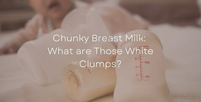 Chunky Breast Milk: What are Those White Clumps?