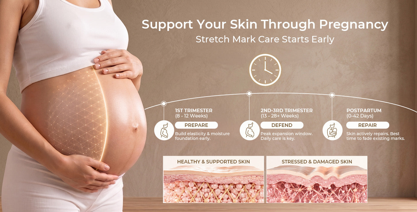 How to Prevent Stretch Marks During Pregnancy And When to Start Using Stretch Mark Cream