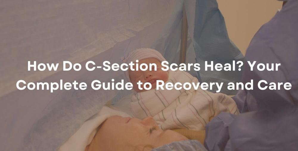How Do C-Section Scars Heal? Your Complete Guide to Recovery and Care