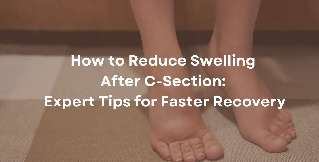 How to Reduce Swelling After C-Section: Expert Tips for Faster Recovery