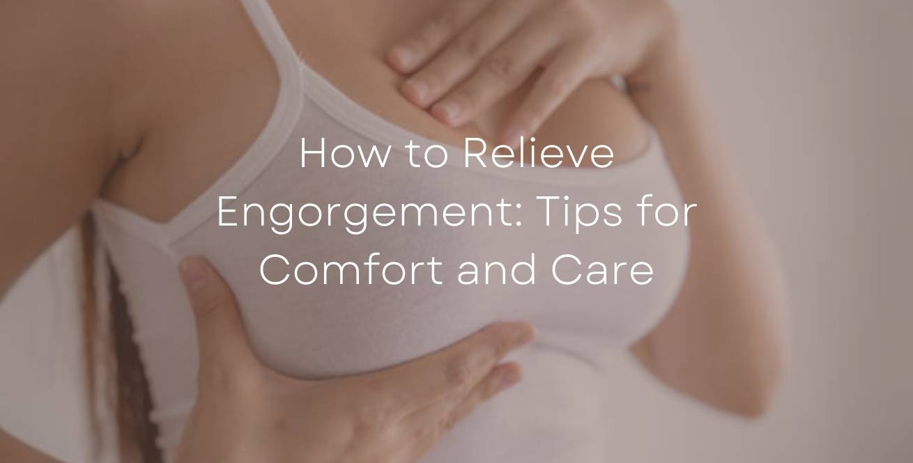 Comment soulager l’engorgement : conseils pour un allaitement confortable et serein
