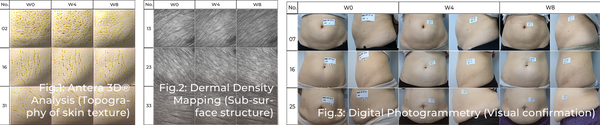 Thumb image